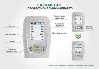 СКЭНАР-1-НТ (исполнение 01)  в Куйбышеве купить Медицинская техника - denasosteo.ru 